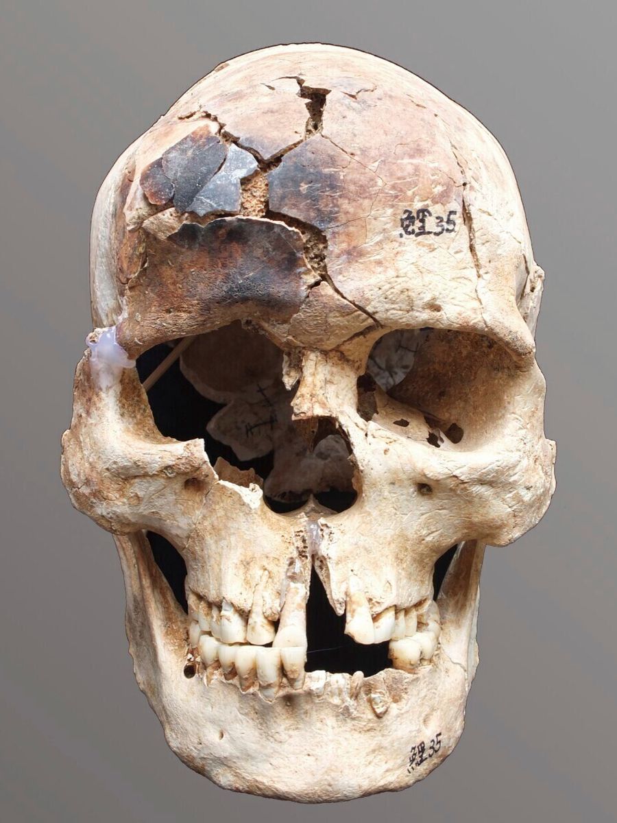 skynews-china-mummies-skull_7021687
