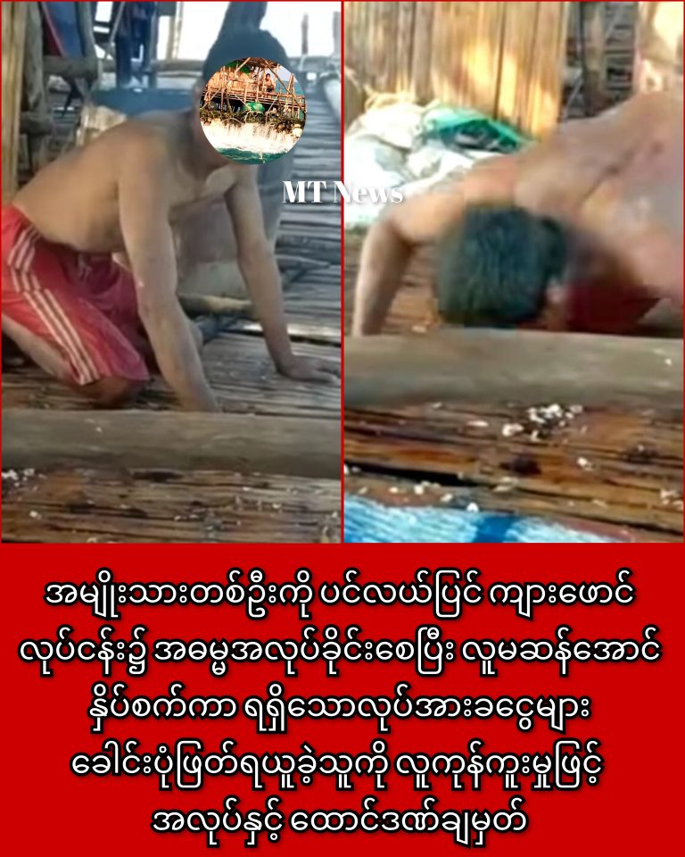 1000036831